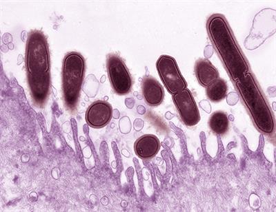 Gardnerella vaginalis фото